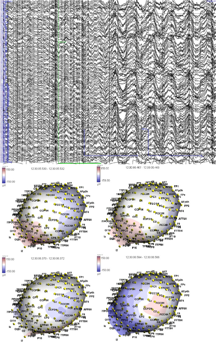 Fig. 1