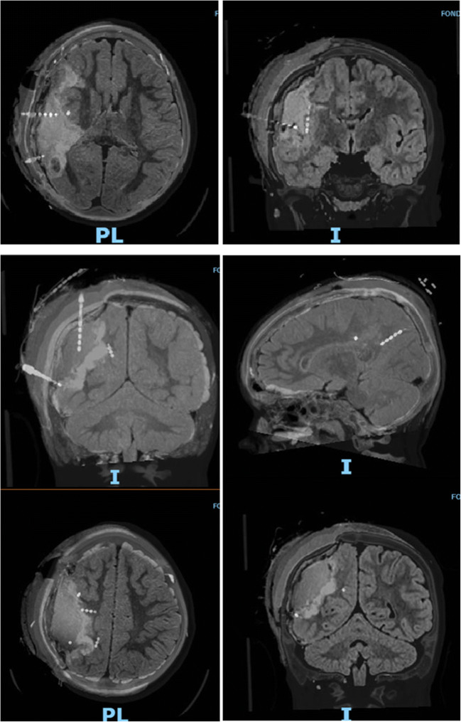 Fig. 5