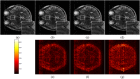 Fig 9