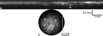 Fig. 8