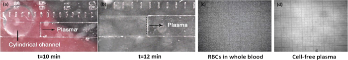 Figure 11