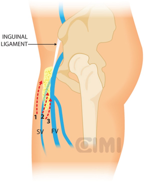 Figure 10.