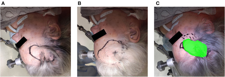 Figure 11