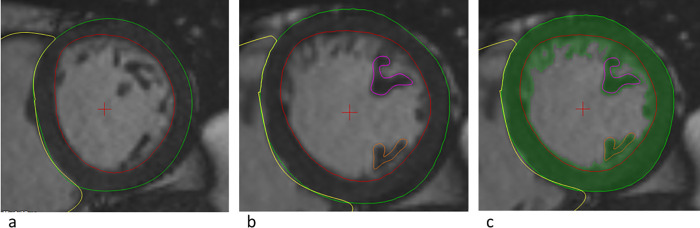 Fig 1