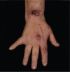 Fig 3.