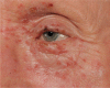 Fig 2.