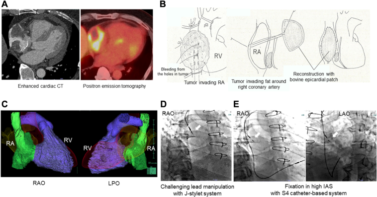 Figure 1