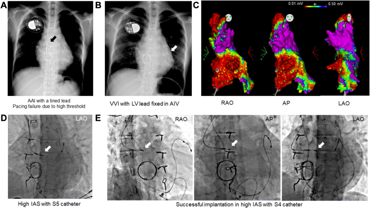 Figure 3