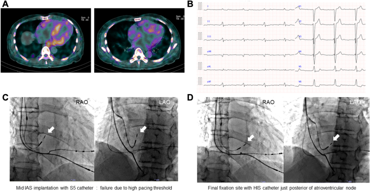 Figure 2