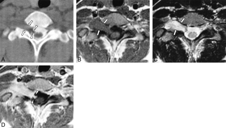 fig 3.