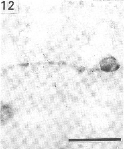 Fig. 12