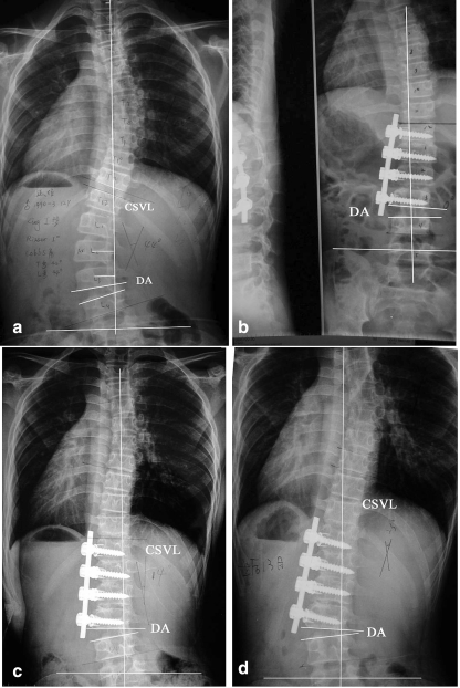 Fig 1