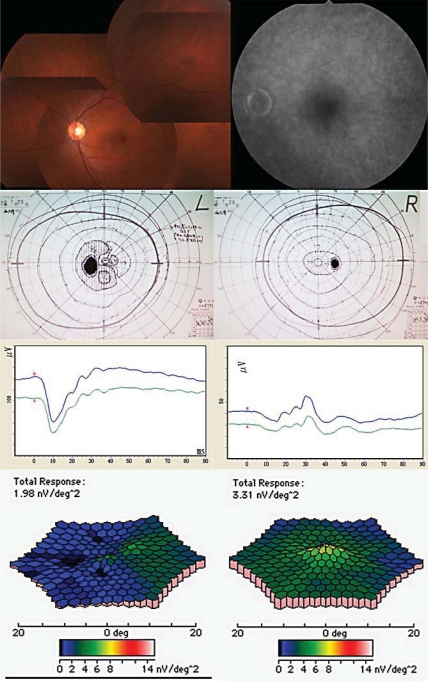 Fig. 1