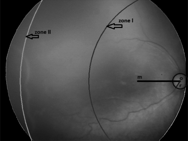 Fig. 12