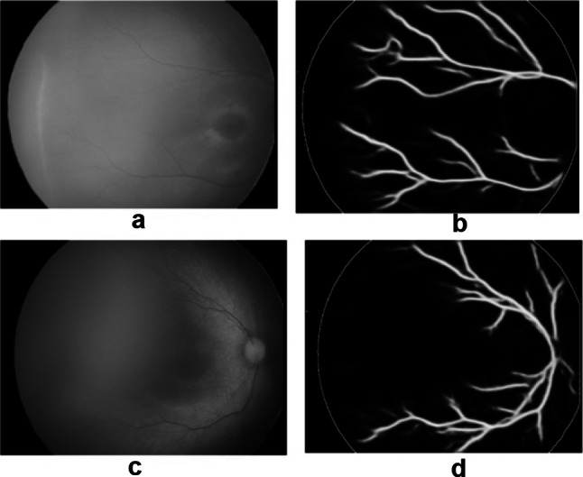 Fig. 13