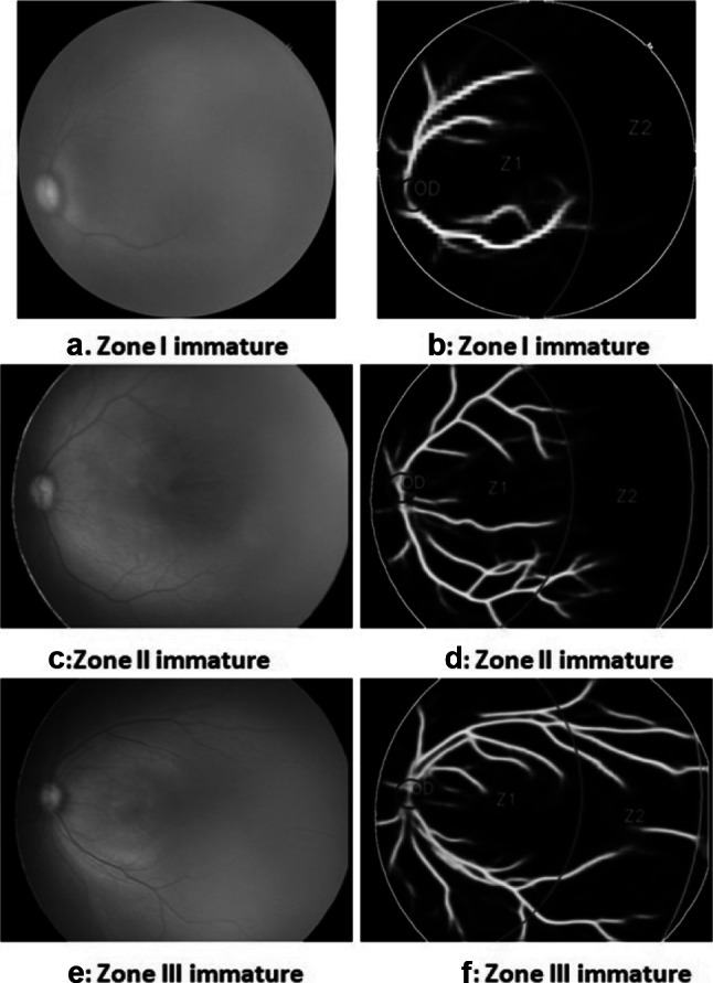 Fig. 14