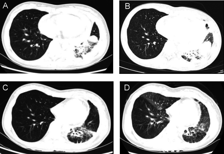 Fig. 1