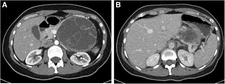 FIG. 1.