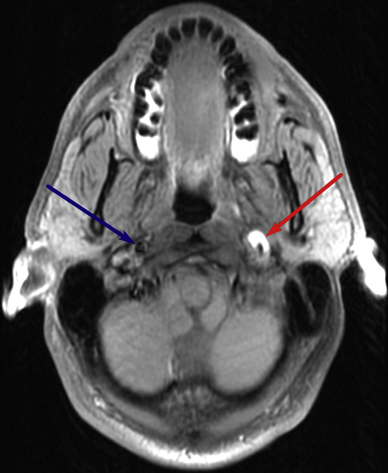 Fig. 1