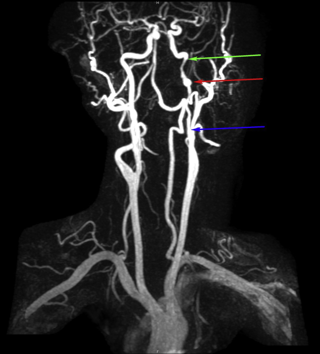 Fig. 2