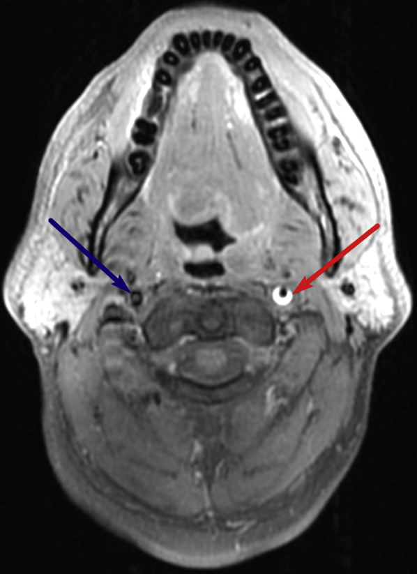 Fig. 4