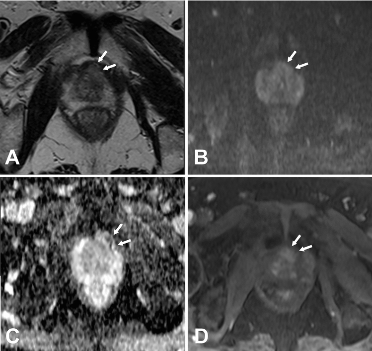 Fig. 9