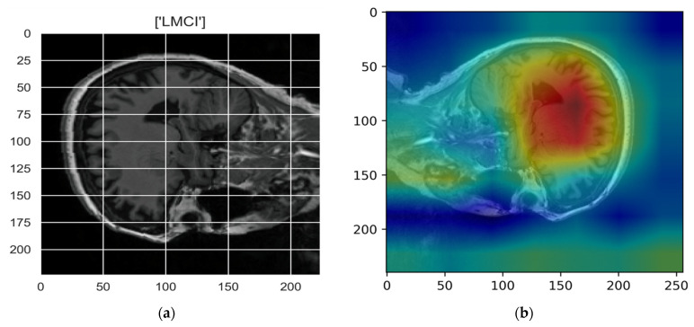 Figure 14