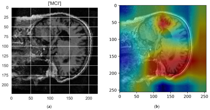 Figure 13