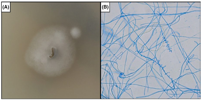 FIGURE 3