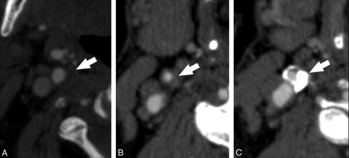 Fig 2.