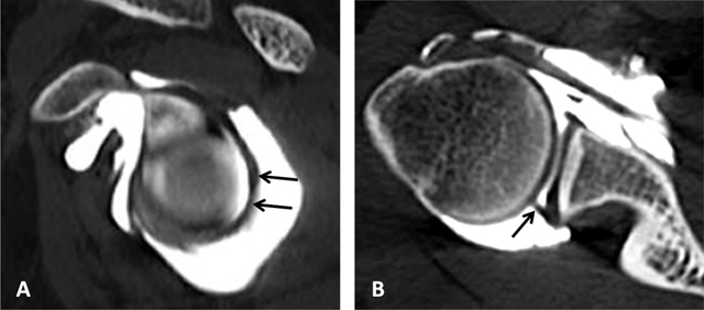 Figure 19