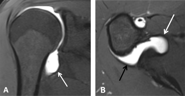 Figure 22