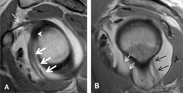 Figure 23