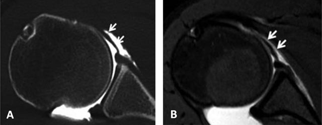 Figure 20