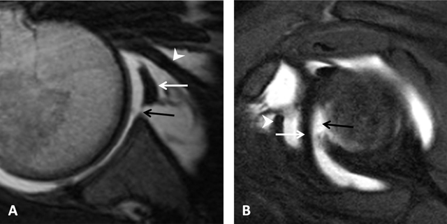 Figure 15