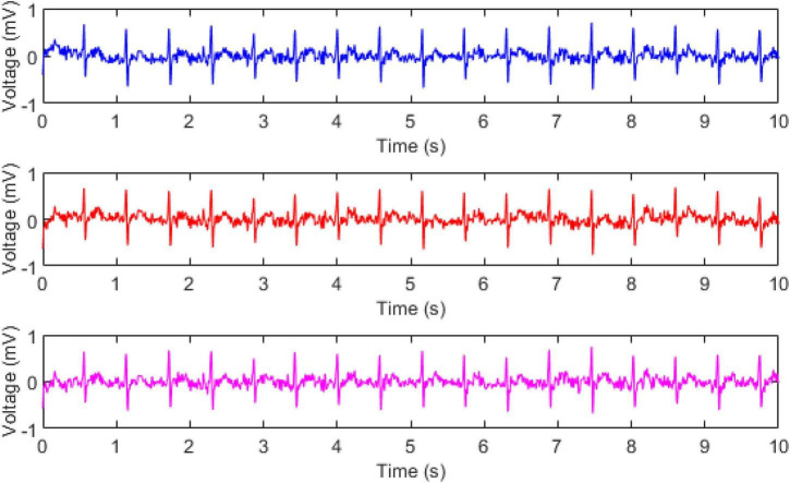 FIGURE 4