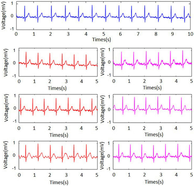 FIGURE 3