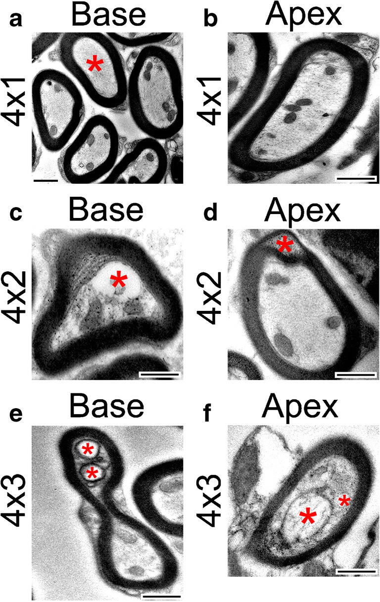 Fig. 15