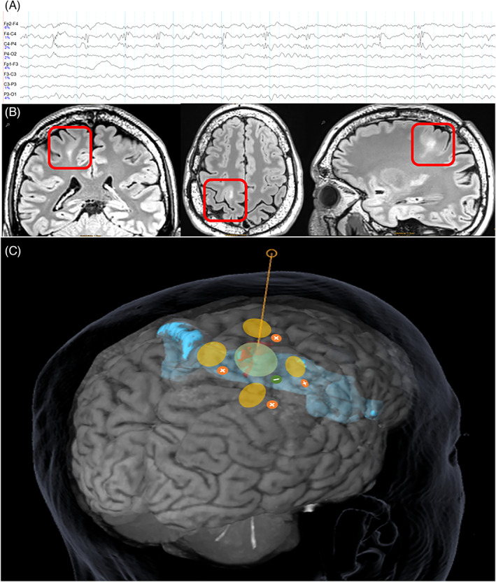 FIGURE 1