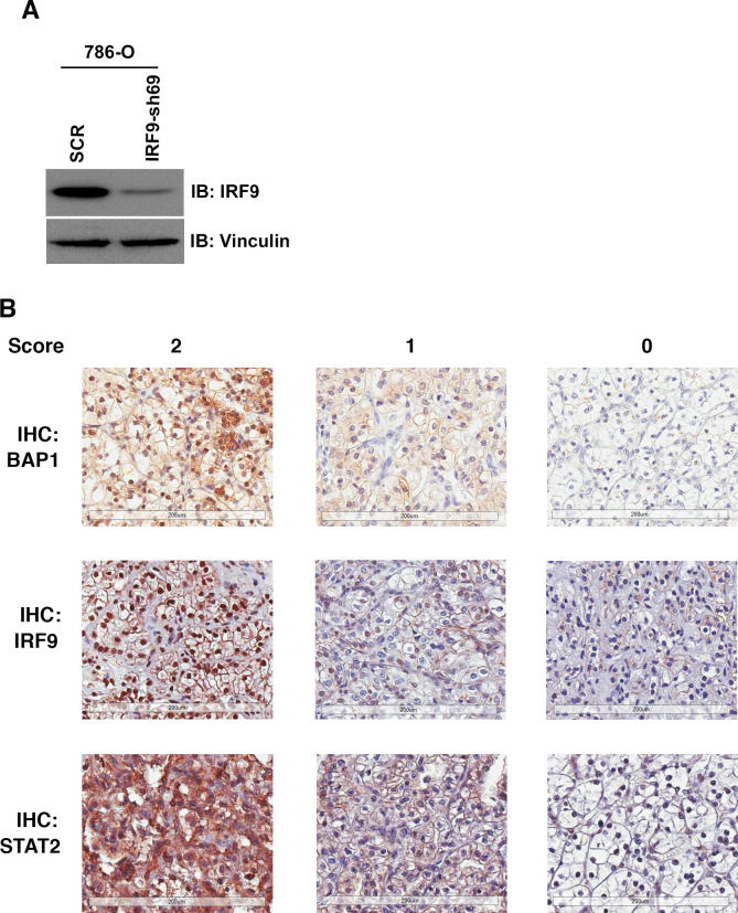 Figure 9—figure supplement 3.