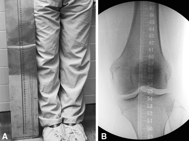 Fig. 1A–B