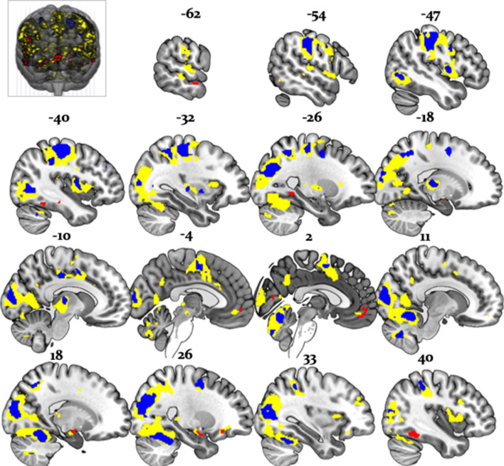 Figure 11.