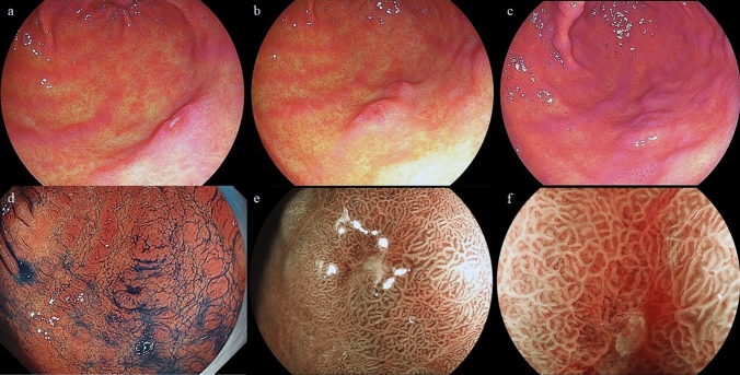 Fig. 1