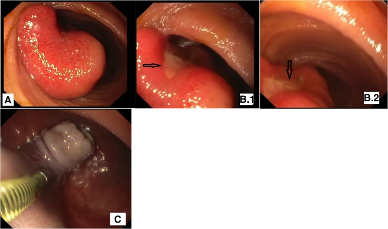 Fig. 2