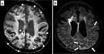 Fig. 15