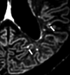 Fig.11