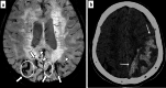 Fig.5