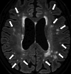 Fig.10