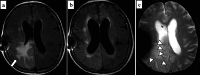 Fig. 13