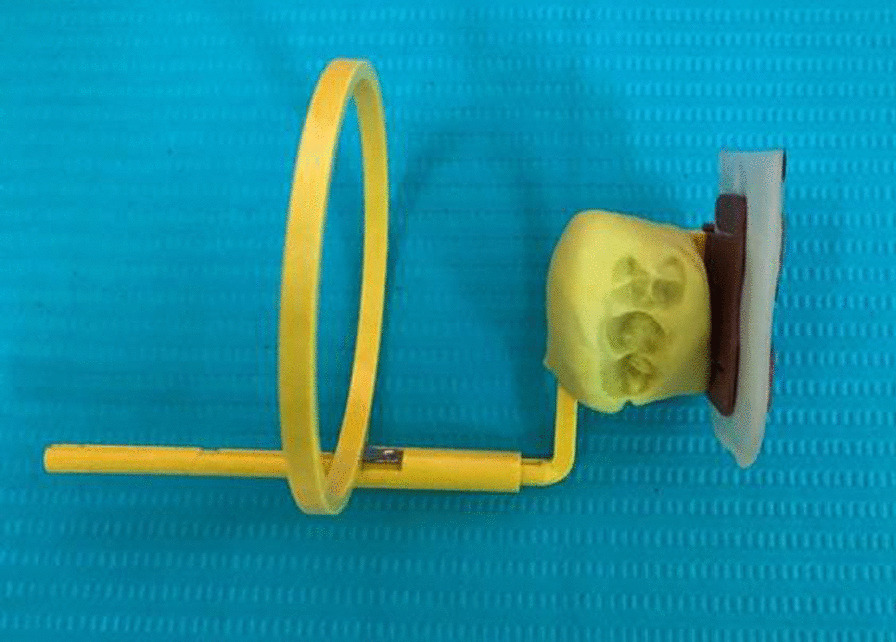 Fig. 1